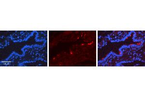 Rabbit Anti-SCGB1A1 Antibody   Formalin Fixed Paraffin Embedded Tissue: Human Lung Tissue Observed Staining: Cytoplasm, Plasma membrane Primary Antibody Concentration: 1:600 Other Working Concentrations: N/A Secondary Antibody: Donkey anti-Rabbit-Cy3 Secondary Antibody Concentration: 1:200 Magnification: 20X Exposure Time: 0. (SCGB1A1 抗体  (Middle Region))
