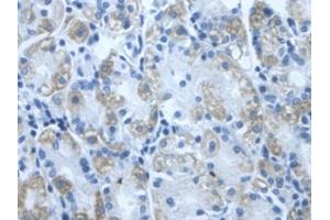 DAB staining on IHC-P; Samples: Human Stomach Tissue (DLD 抗体  (AA 280-487))