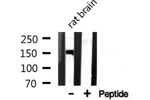 Western Blotting (WB) image for anti-Chromatin Assembly Factor 1, Subunit A (p150) (CHAF1A) (Internal Region) antibody (ABIN6257706)