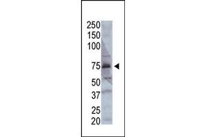 Image no. 1 for anti-Acyl-CoA Synthetase Long-Chain Family Member 4 (ACSL4) (AA 244-274) antibody (ABIN357780) (ACSL4 抗体  (AA 244-274))