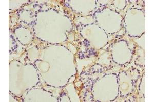 Immunohistochemistry of paraffin-embedded human thyroid tissue using ABIN7161614 at dilution of 1:100 (NINJ2 抗体  (AA 17-81))