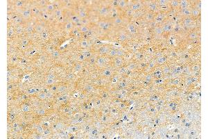 ABIN6261368 and ABIN6273232 at 1/100 staining Rat brain tissue by IHC-P. (DBN1 抗体  (Internal Region))