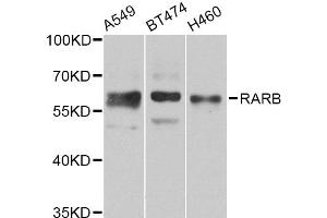Western blot analysis of extracts of various cell lines, using RARB Antibody (ABIN5975866) at 1/1000 dilution. (Retinoic Acid Receptor beta 抗体)