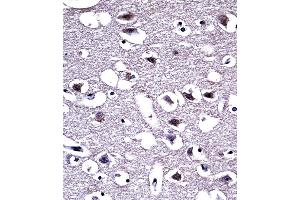 OPRM1 Antibody (Center) ((ABIN653074 and ABIN2842674))immunohistochemistry analysis in formalin fixed and paraffin embedded human brain tissue followed by peroxidase conjugation of the secondary antibody and DAB staining. (Mu Opioid Receptor 1 抗体  (AA 161-187))