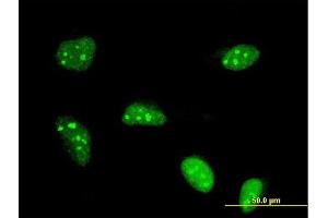 Immunofluorescence of monoclonal antibody to POLR1B on HeLa cell. (POLR1B 抗体  (AA 963-1072))
