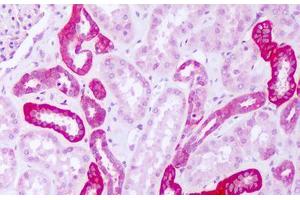 Image no. 1 for anti-Phenylalanyl-tRNA Synthetase, alpha Subunit (FARSA) (AA 276-325) antibody (ABIN6749793) (Phenylalanyl-tRNA Synthetase, alpha Subunit (FARSA) (AA 276-325) 抗体)