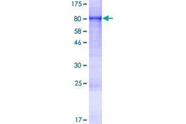 FEM1C Protein (AA 1-617) (GST tag)