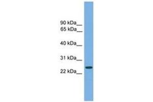 Image no. 1 for anti-Charged Multivesicular Body Protein 4B (CHMP4B) (AA 71-120) antibody (ABIN6745025) (CHMP4B 抗体  (AA 71-120))