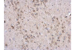 IHC-P Image INPP5F antibody detects INPP5F protein at cytosol on mouse fore brain by immunohistochemical analysis. (INPP5F 抗体)