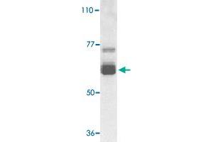 Western blot analysis of IL22RA1 expression in human HepG2 cell lysate with IL22RA1 polyclonal antibody  at 1 ug /mL . (IL22 Receptor alpha 1 抗体  (N-Term))