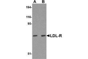 Western Blotting (WB) image for anti-Low Density Lipoprotein Receptor (LDLR) (Middle Region) antibody (ABIN1030978) (LDLR 抗体  (Middle Region))