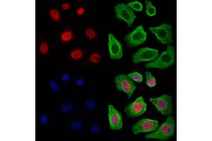 ABIN6260349 and ABIN6269173 staining Hela cells by IF/ICC.