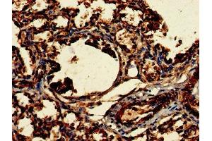 Immunohistochemistry of paraffin-embedded human lung tissue using ABIN7147821 at dilution of 1:100 (Clarin 2 抗体  (AA 31-100))