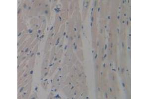 Used in DAB staining on fromalin fixed paraffin- embedded Kidney tissue (SIRPB1 抗体  (AA 129-342))