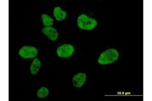 Immunofluorescence (IF) image for anti-CREB Binding Protein (CREBBP) (AA 951-1050) antibody (ABIN560465)