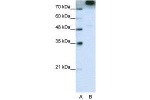 WB Suggested Anti-EIF3S9  Antibody Titration: 0. (EIF3B 抗体  (C-Term))