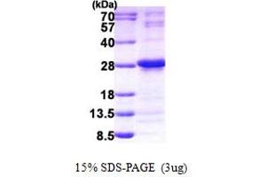 SDS-PAGE (SDS) image for Nudix (Nucleoside Diphosphate Linked Moiety X)-Type Motif 4 (NUDT4) (AA 1-180) protein (His tag) (ABIN5852976) (NUDT4 Protein (AA 1-180) (His tag))