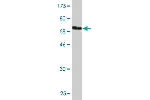 Western Blot detection against Immunogen (67. (CKM 抗体  (AA 1-381))