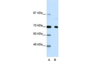 Western Blotting (WB) image for anti-Nuclear Receptor Co-Repressor 2 (NCOR2) antibody (ABIN2460476) (NCOR2 抗体)