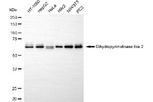 Western blotting analysis using dihydropyrimidinase like 2 antibody (ABIN7798337). (Recombinant DPYSL2 抗体)