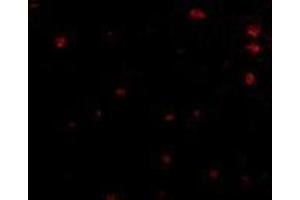 Immunofluorescence of human brain tissue using AP30335PU-N FEZ2 antibody at 5 μg/ml. (FEZ2 抗体  (Center))