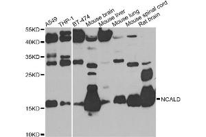 Western blot analysis of extracts of various cell lines, using NCALD antibody. (NCALD 抗体)