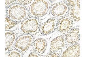 ABIN6259171 and ABIN6275708 at 1/100 staining Rat testis tissue by IHC-P. (RAD51C 抗体  (Internal Region))