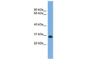 WB Suggested Anti-CENPH Antibody Titration: 0. (CENPH 抗体  (N-Term))