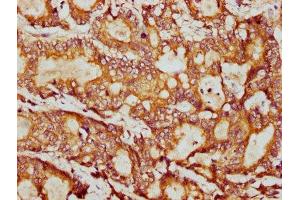 Immunohistochemistry (IHC) image for anti-Proteasome (Prosome, Macropain) Subunit, beta Type, 9 (Large Multifunctional Peptidase 2) (PSMB9) (AA 21-219) antibody (ABIN7164994)