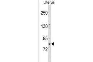ZN Antibody (N-term) (ABIN1539004 and ABIN2850297) western blot analysis in Uterus tissue lysates (35 μg/lane). (ZNF853 抗体  (N-Term))