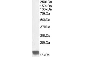 Western Blotting (WB) image for anti-Ubiquitin-Conjugating Enzyme E2I (UBE2I) (N-Term) antibody (ABIN184894)