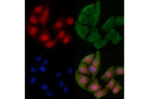 ABIN6255040 and ABIN6267230 staining Hela cells by IF/ICC. (IKK-alpha /IKK-beta 抗体  (pSer180, pSer181))