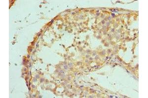 Immunohistochemistry of paraffin-embedded human testis tissue using ABIN7150715 at dilution of 1:100 (MAP2K5 抗体  (AA 1-190))