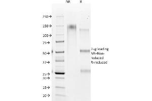 SDS-PAGE Analysis Purified HSA Mouse Monoclonal Antibody (HSA98). (Hepatocyte Specific Antigen 抗体)