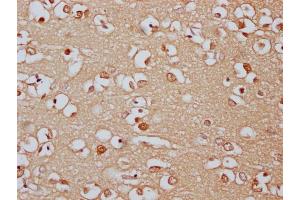 IHC image of ABIN7166521 diluted at 1:300 and staining in paraffin-embedded human brain tissue performed on a Leica BondTM system. (PCDHa8 抗体  (AA 719-922))