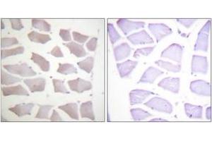 Immunohistochemistry analysis of paraffin-embedded human skeletal muscle tissue, using CRYAB (Ab-19) Antibody. (CRYAB 抗体  (AA 10-59))