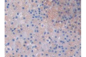 Used in DAB staining on fromalin fixed paraffin- embedded skeletal muscle tissue (LOXL2 抗体  (AA 434-546))