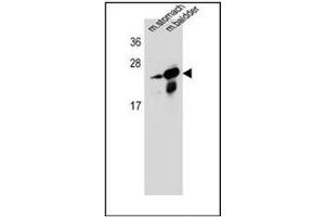 Western Blotting (WB) image for anti-RAB25, Member RAS Oncogene Family (RAB25) (AA 112-141), (Middle Region) antibody (ABIN954409)