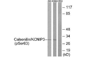Immunohistochemistry analysis of paraffin-embedded human brain tissue using Calsenilin/KCNIP3 (Phospho-Ser63) antibody. (DREAM 抗体  (pSer63))