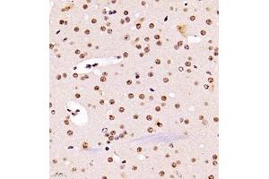 Immunohistochemistry (Paraffin-embedded Sections) (IHC (p)) image for anti-Ubiquitin Specific Peptidase 34 (USP34) antibody (ABIN7076115)