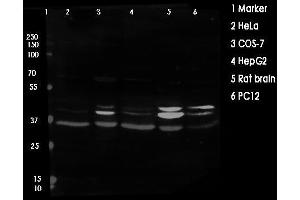 Western blot analysis of ERK1/2 using various lysates Lanes 1 - 2: Merged signal (red and green).