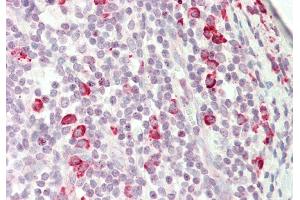 Rabbit Anti-KIAA0317 antibody  Formalin Fixed Paraffin Embedded Tissue: Human Tonsil Primary antibody Concentration: 1:100 Secondary Antibody: Donkey anti-Rabbit-Cy3 Secondary Antibody Concentration: 1:200 Magnification: 20x Exposure Time: 0. (AREL1 抗体  (N-Term))