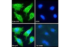 ABIN6391344 Immunofluorescence analysis of paraformaldehyde fixed HepG2 cells, permeabilized with 0. (CTGF 抗体  (Internal Region))