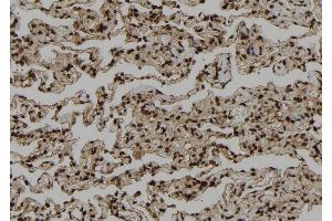 ABIN6272402 at 1/100 staining Human lung tissue by IHC-P. (PSKH1 抗体  (Internal Region))