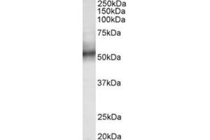 AP31785PU-N TRIM11 antibody staining of Human spleen lysate at 0. (TRIM11 抗体  (Internal Region))