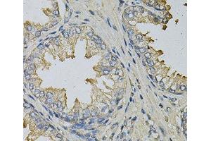 Immunohistochemistry of paraffin-embedded Human prostate using LITAF Polyclonal Antibody at dilution of 1:100 (40x lens). (LITAF 抗体)