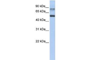 WB Suggested Anti-EPN1 Antibody Titration: 0. (Epsin 1 抗体  (C-Term))