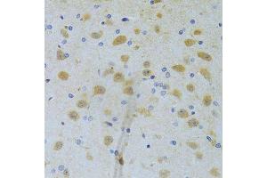 Immunohistochemistry of paraffin-embedded rat brain using CHIA Antibody. (CHIA 抗体  (AA 1-368))