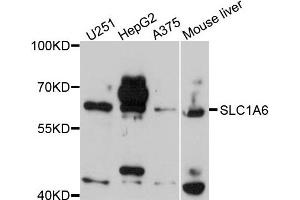 Western blot analysis of extracts of various cells, using SLC1A6 antibody. (SLC1A6 抗体)