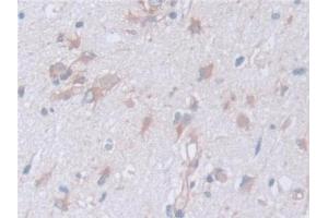 Detection of CAPNS1 in Human Cerebrum Tissue using Polyclonal Antibody to Calpain, Small Subunit 1 (CAPNS1) (Calpain S1 抗体  (AA 1-268))